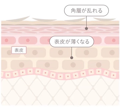 エトヴォス 肌に悪い,アルティモイストキット エトヴォス