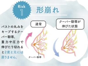 ルルクシェル 効果,ルルクシェル ナイトブラ 口コミ,ルルクシェル 体験レビュー